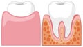 A Cartoon of Human Teeth Royalty Free Stock Photo