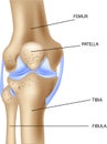 Cartoon illustration of the human knee joint anatomy