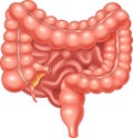 Cartoon Illustration of Large and Small Intestine