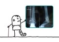 Cartoon man injured his foot showing an X-ray