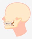 Cartoon model of human dental jaw side view vector flat illustration