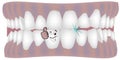 Cartoon shape dentures dental service denture care