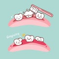 Cartoon tooth brush and gingivitis Royalty Free Stock Photo