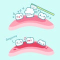 Cartoon tooth brush and gingivitis Royalty Free Stock Photo