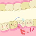 Cartoon tooth decay problem