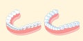 Cartoon tooth wear different brace