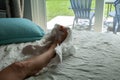 Cast removed from a foot after bunion surgery