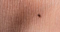 A castor bean tick Ixodes ricinus crawling on human skin Royalty Free Stock Photo