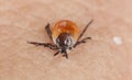 Castor bean tick, Ixodes ricinus on human skin Royalty Free Stock Photo