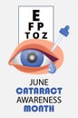 Cataract awareness month is celebrated in June. Glaucoma disease and nephropathy problems. Ophthalmologist, oculist