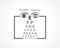 Cataract Awareness Month observed in June, It is a dense, cloudy area that forms in the lens of the eye