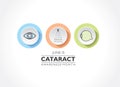 Cataract Awareness Month observed in June, It is a dense, cloudy area that forms in the lens of the eye