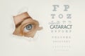 Cataract disease poster wwith eye test chart and blue eye on left