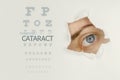 Cataract disease poster wwith eye test chart and blue eye on right.