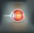 Cataracts abstract grey background Royalty Free Stock Photo
