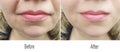 Wrinkle,forehead,skin,cheek,face,lips Royalty Free Stock Photo