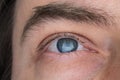 Caucasian male blue eye, close up studio shot, natural look, no makeup Royalty Free Stock Photo