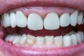 Caucasian male open mouth showing row of white teeth and back of the throat. Close up macro shot, unrecognizable face Royalty Free Stock Photo