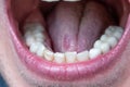 Caucasian male open mouth showing row of white teeth and back of the throat. Close up macro shot, unrecognizable face Royalty Free Stock Photo