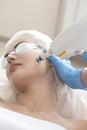 Laser Procedures Ideas. Caucasian Woman Getting Cosmetology Laser Facial Beauty Treatment While Removing Pigmentation in Clinic Royalty Free Stock Photo