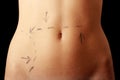 Caucasian woman's abdomen marked with lines Royalty Free Stock Photo