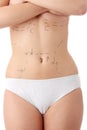 Caucasian woman's abdomen marked with lines Royalty Free Stock Photo
