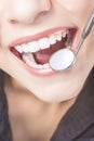 Caucasian Woman White Teeth with Dentist Mouth Mirror