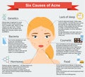Causes of acne. Skin problems and diseases beauty infographics Royalty Free Stock Photo