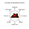 Causes of blood in feces. Diseases of the gastrointestinal tract. Infographics. Vector illustration on isolated