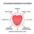 The causes of cracking in the tongue. Definition of a disease according to human tongue. Diagnostics by tongue. Tongue Royalty Free Stock Photo