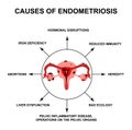 Causes of endometriosis. Adenomyosis. The structure of the pelvic organs with endometriosis. Infographics. Vector