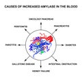 Causes of increased amylase in the blood. The enzyme amylase. Infographics. Vector illustration on isolated background Royalty Free Stock Photo