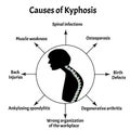 Causes of kyphosis. Spinal curvature, kyphosis, lordosis, scoliosis, arthrosis. Poor posture and slouching. Infographics