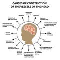 Causes of narrowing of cerebral vessels. World Stroke Day. Infographics. Vector illustration on isolated background