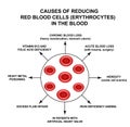 Causes of Reducing Red Blood Cells. Cells erythrocytes. Hemoglobin. The structure of red blood cells. Infographics