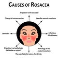 Causes of rosacea. Rosacea Awareness Month. Infographics. Vector illustration on isolated background.