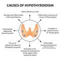 The causes of thyroid hypothyroidism. Infographics. Vector illustration on isolated background. Royalty Free Stock Photo