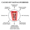 Causes of vaginal dysbiosis. Vaginitis. Candidiasis. Infographics.