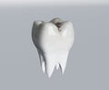 Cavities of molar tooth Royalty Free Stock Photo