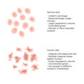 Cell structure: normal and cancer