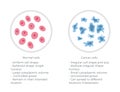 Cell structure: normal and cancer