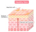 Healthy skin cell turnover illustration. Skin care and beauty concept