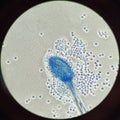 Histology microscopes blood samples