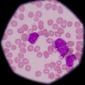 Cells in bone marrow