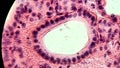 Glandular epithelium, microscopic photo of permanent preparation