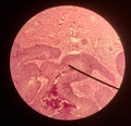 Cells in reproductive female cytology and histology concept