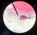 Cells in reproductive female cytology and histology concept