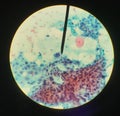 Cells in reproductive female cytology and histology concept