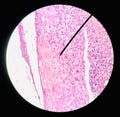 Cells in reproductive female cytology and histology concept