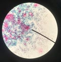 Cells in reproductive female cytology and histology concept